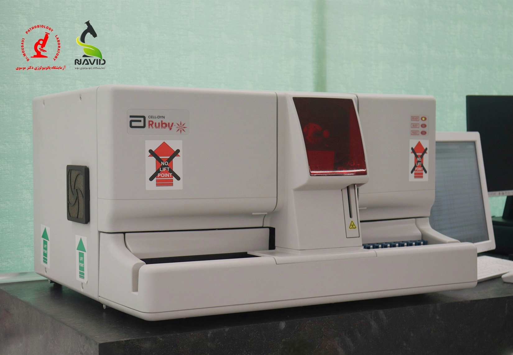 دستگاه Abbott Ruby Cell Counter