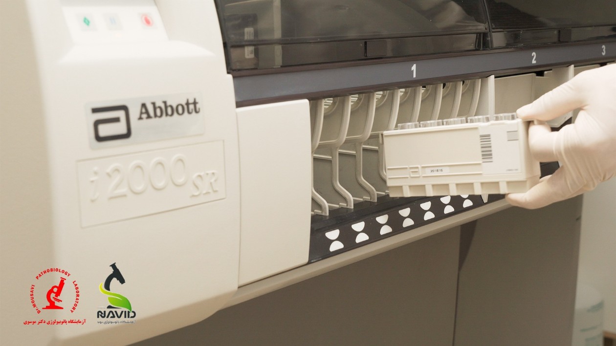دستگاه ARCHITECT i2000SR