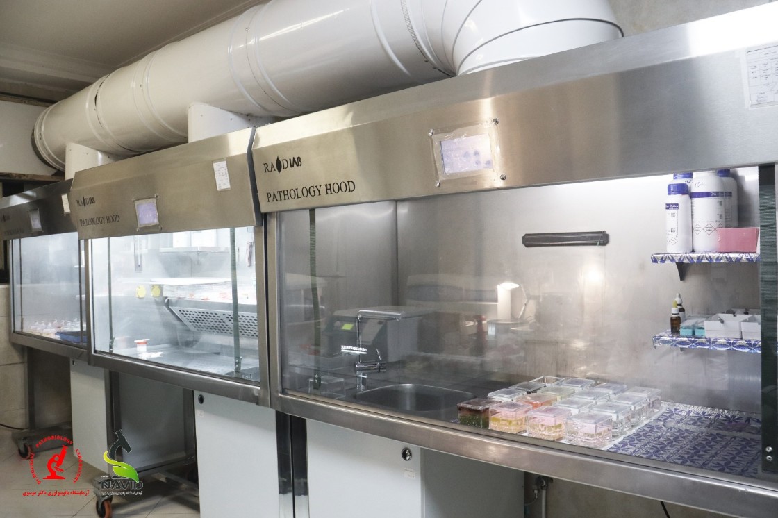 Laminar Flow Hood Class II - B2