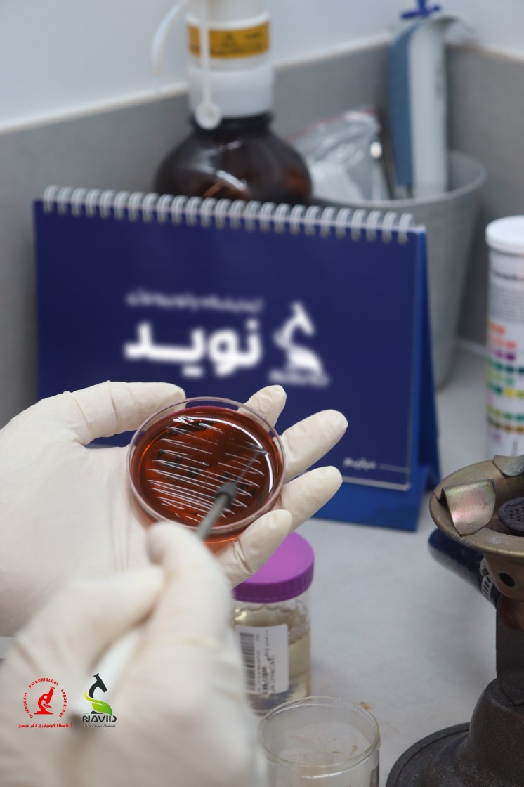میکروبشناسی و آنالیز تجزیه ادرار