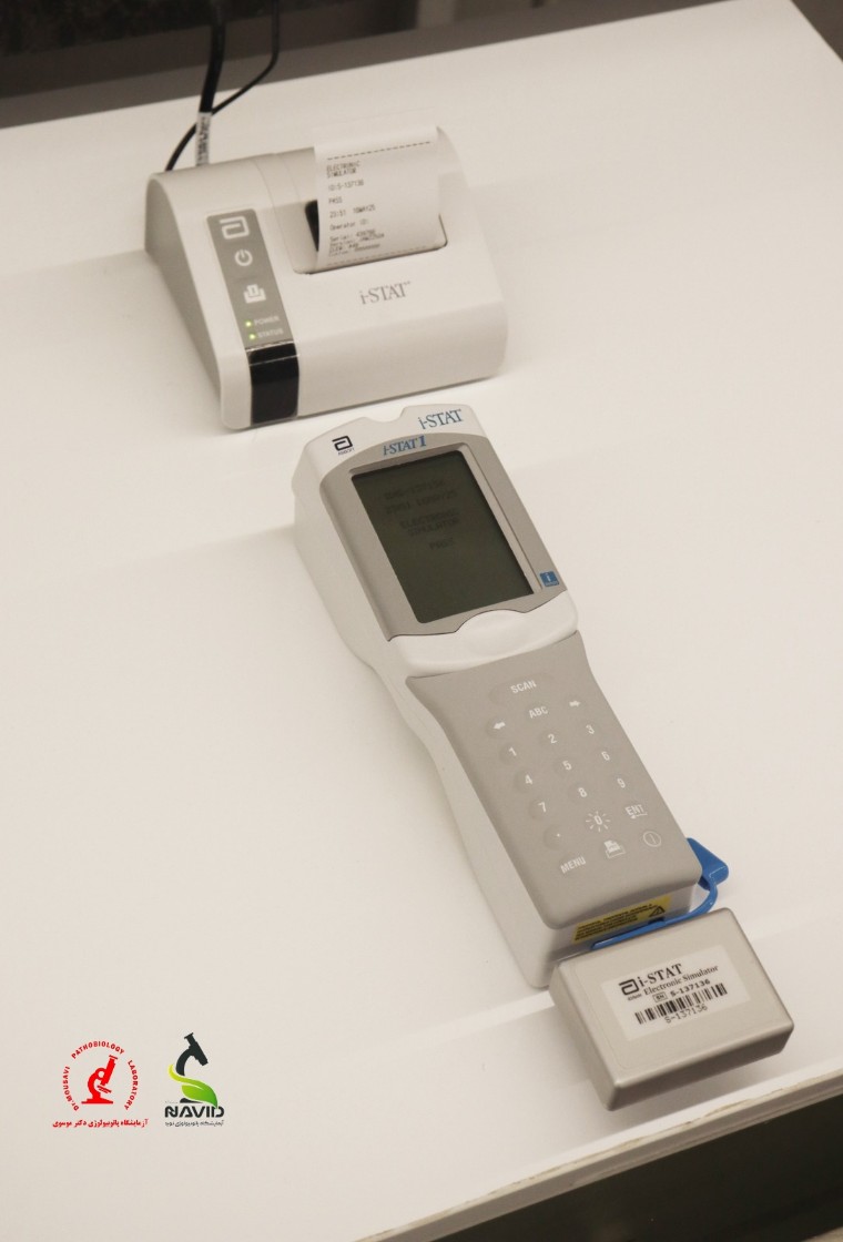 دستگاه Abbotti – STAT