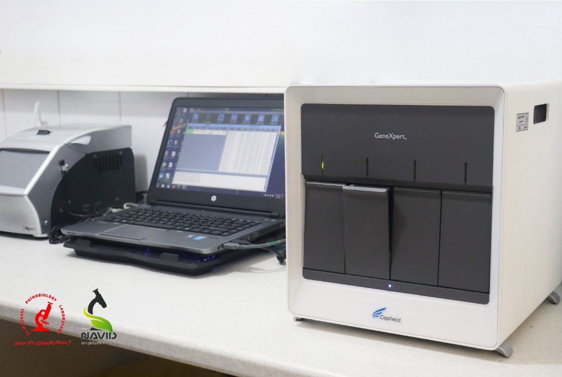 دستگاه  Cepheid GeneXpert System